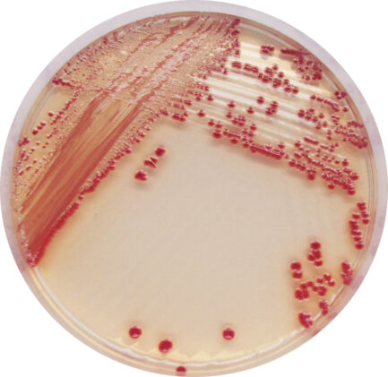 CHROMagar Acinetobacter, 20 placas