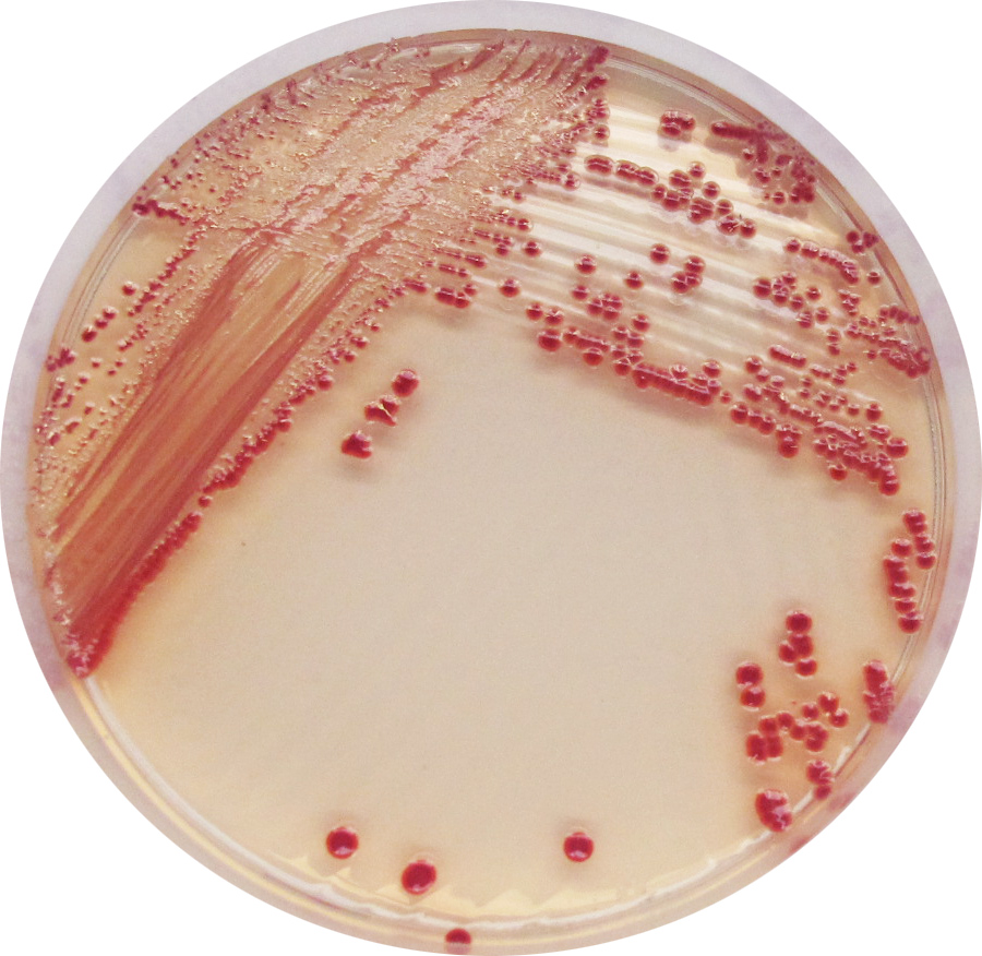 CHROMagar Acinetobacter (20 placas)_image