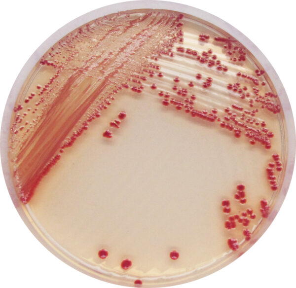 CHROMagar Acinetobacter, 5000ml_image